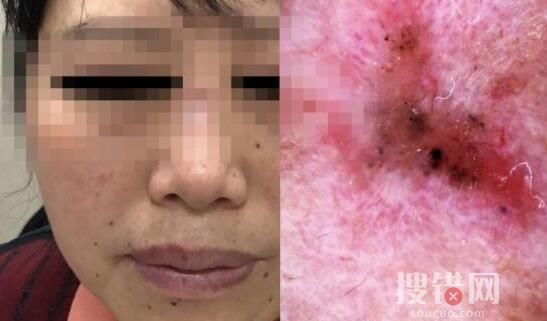 女子陪閨蜜就診自己卻被查出癌癥 醫生一眼就看出來了