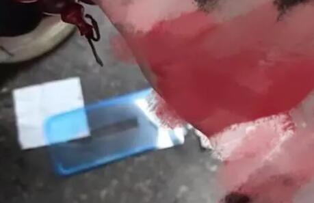 男子被高拋手機盒砸中滿頭血 為什么被砸什么情況？
