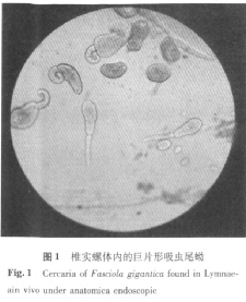 生吃水產會感染寄生蟲？