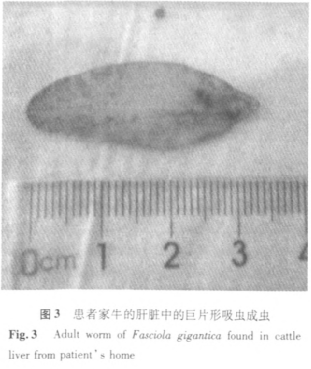 生吃水產會感染寄生蟲？